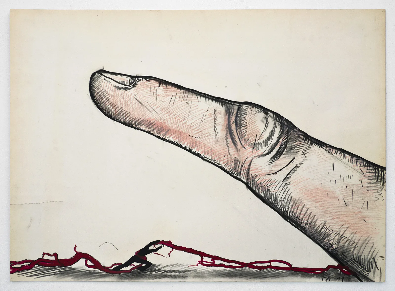 The Worker who cut his Finger as a Strike