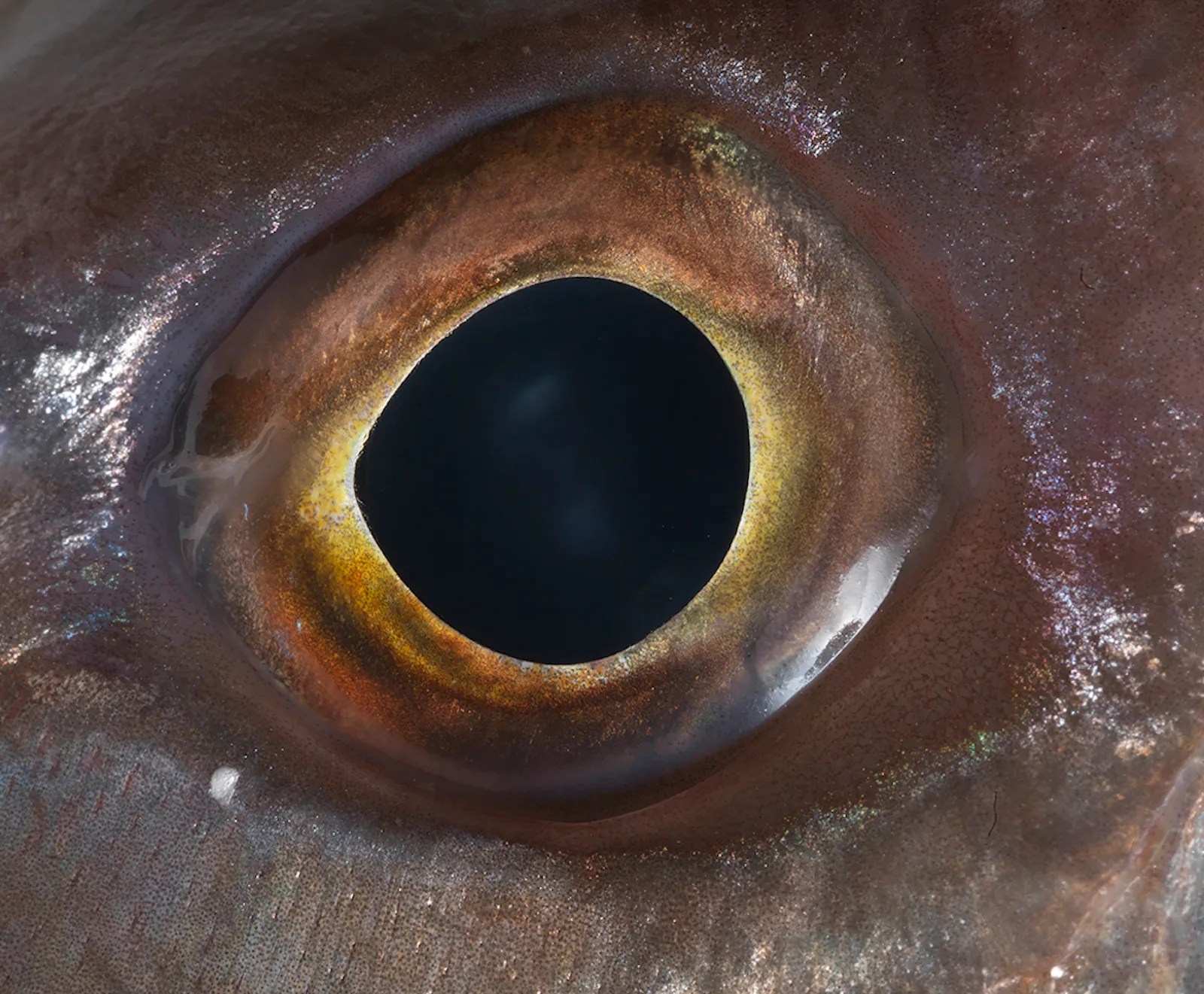 Eye