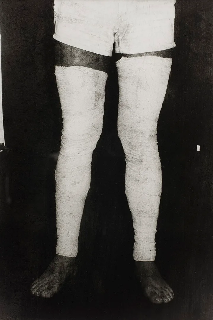 Sem Titulo (Performance com bandagem cirurgica) / Untitled (Performance with surgical bandage)